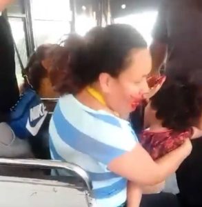Ruta 2 A deja sin dientes a pasajera, circulaba con placas vencidas